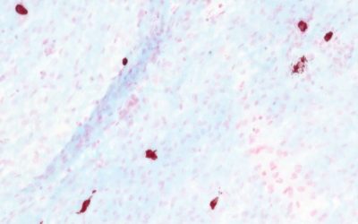 The anti-FcepsilonRI antibody MAR-1 depletes basophils and cross-reacts with myeloid cells through its Fc portion